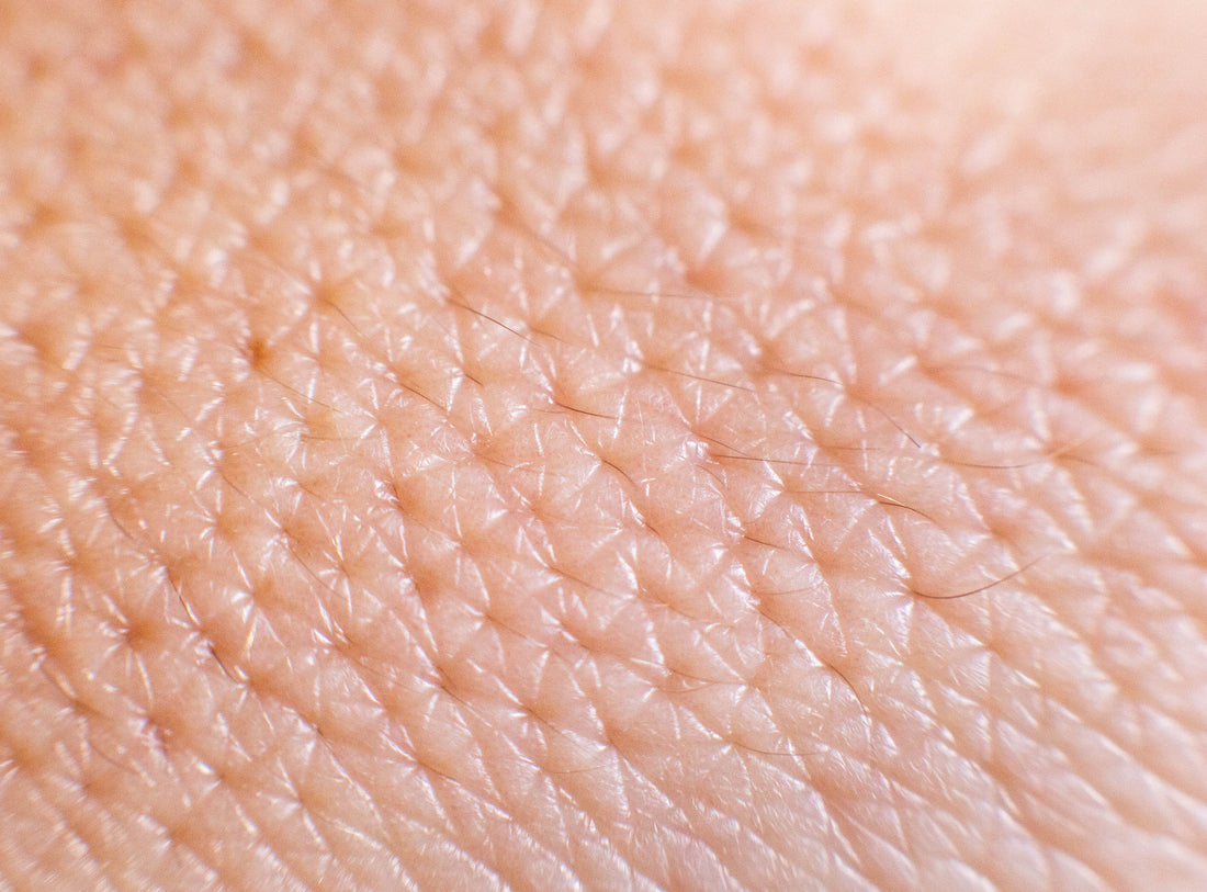 2. Perfect Skin