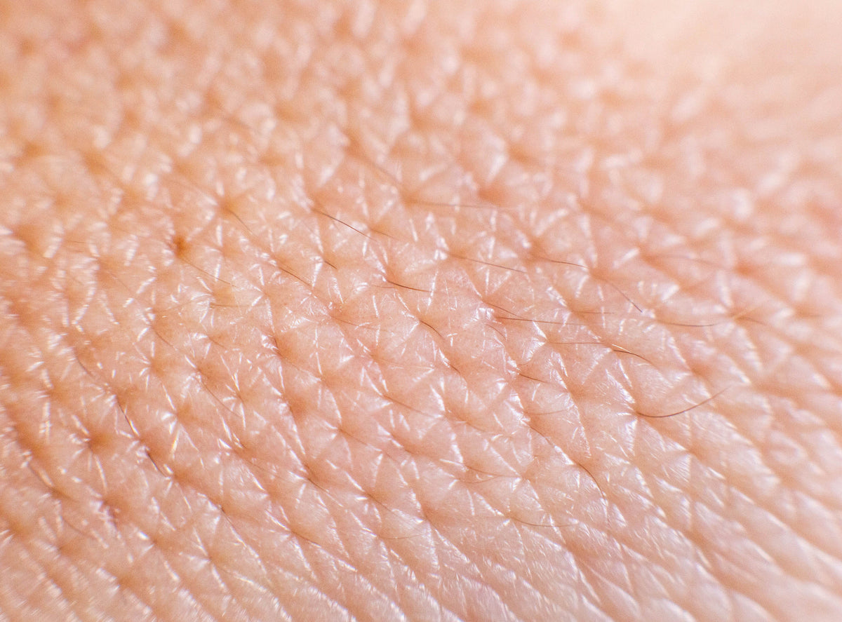 2. Perfect Skin